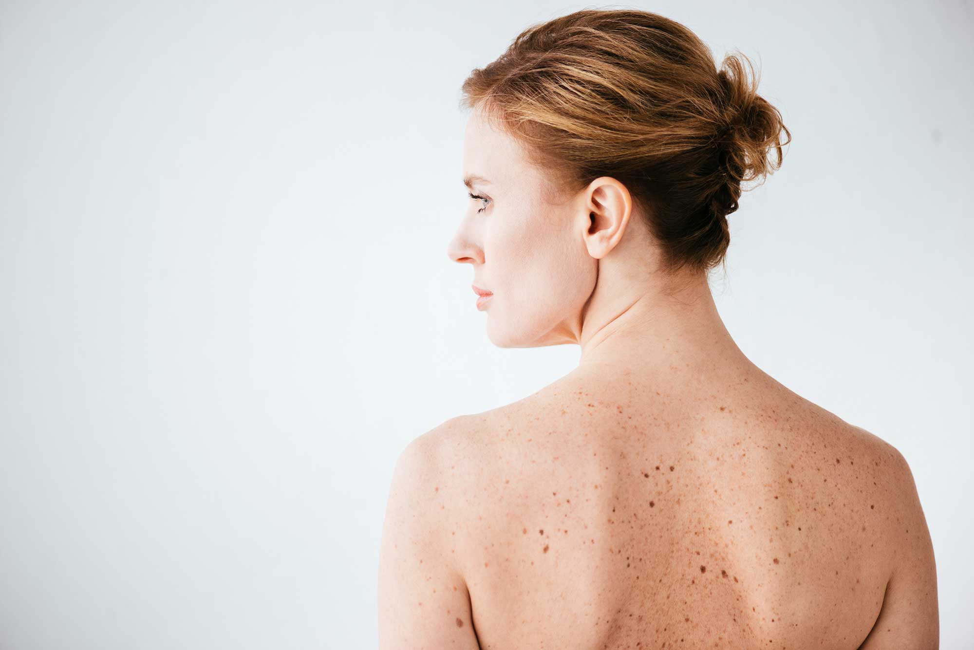 Skin-Cancer